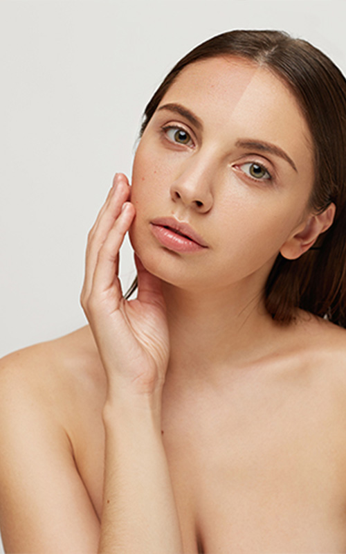 Tratamientos de despigmentación